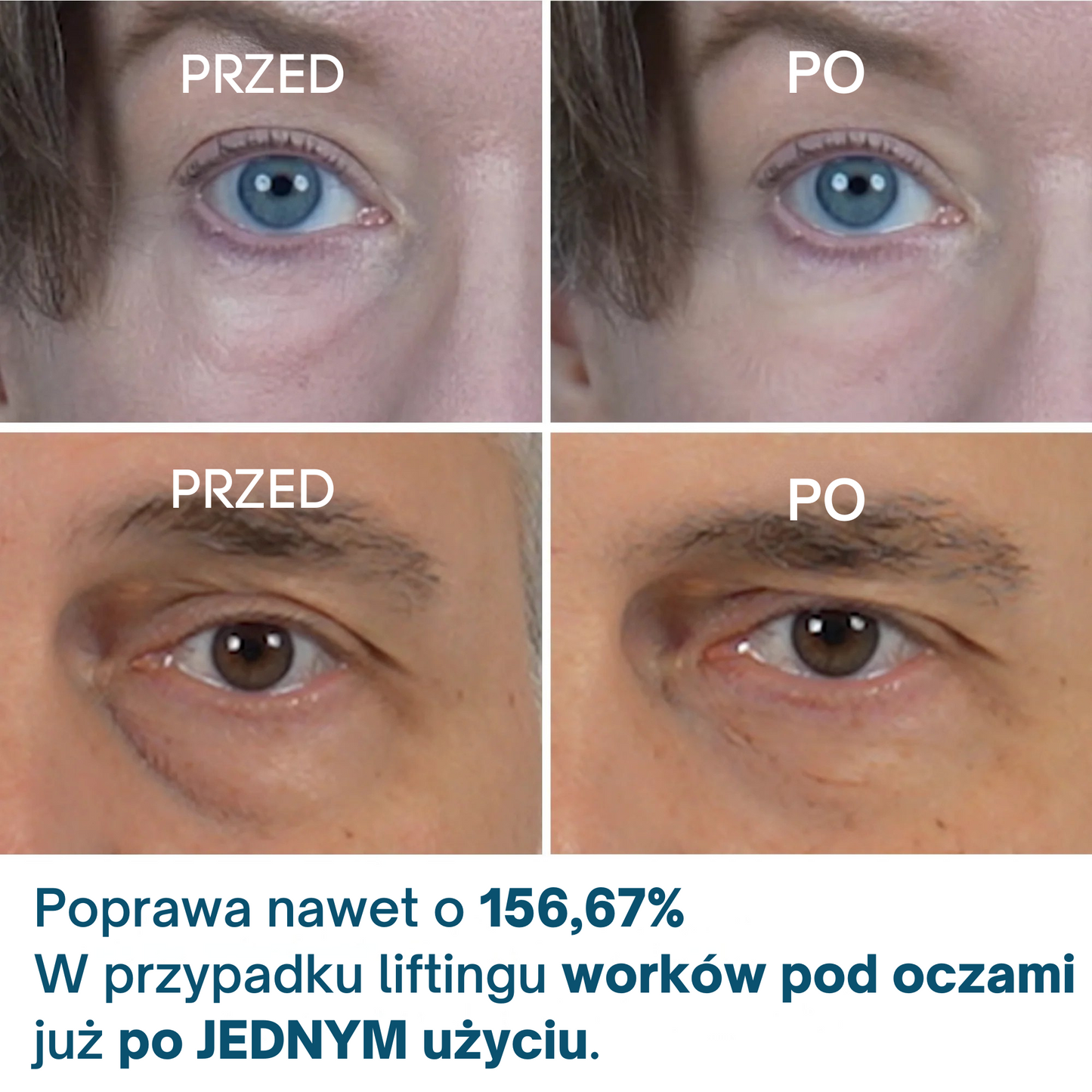 Dr.Melaxin Krem pod oczy Eyephalt