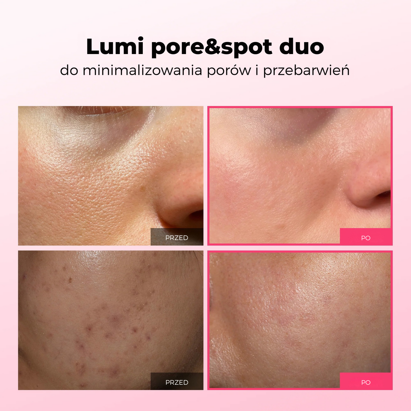 Lumi Pore & Spot Care Duo