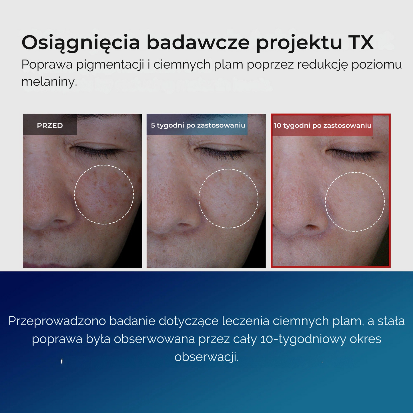 TX Tranexamic Acid Dark Spot Care Line