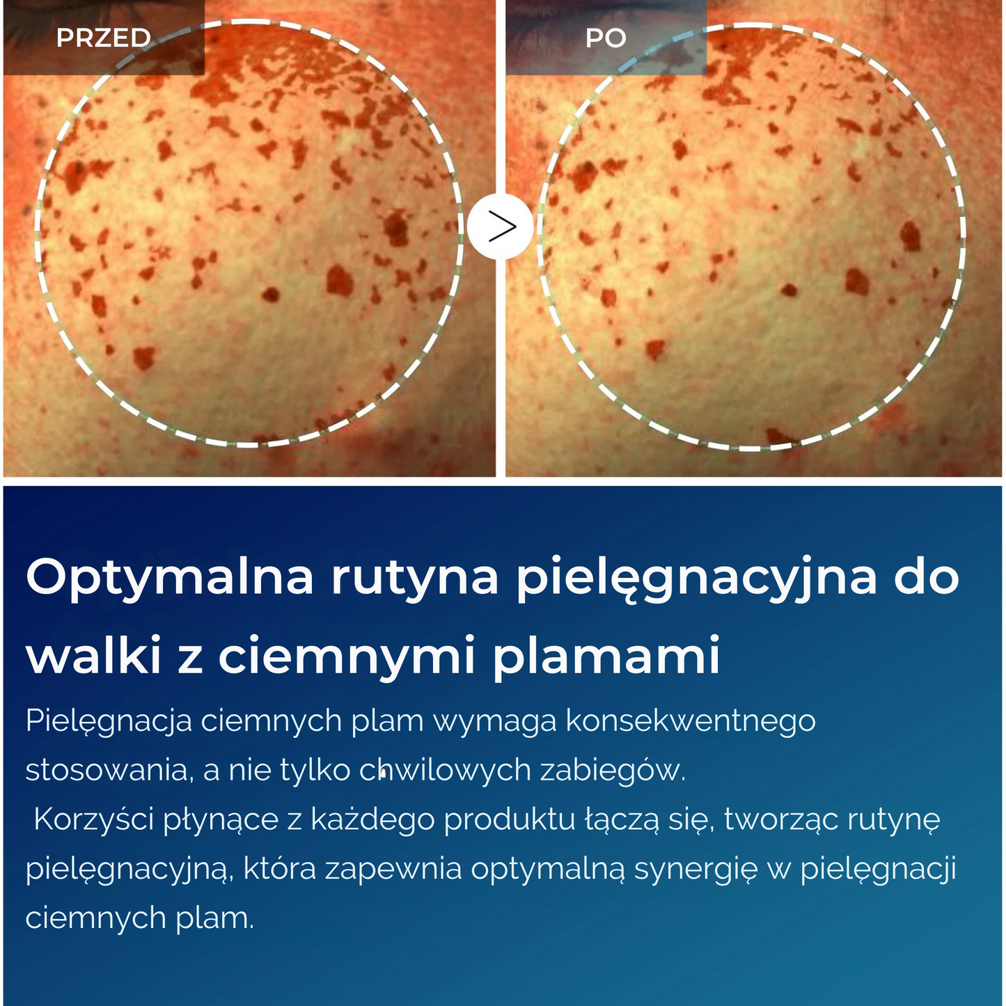 TX Tranexamic Acid Dark Spot Care Line