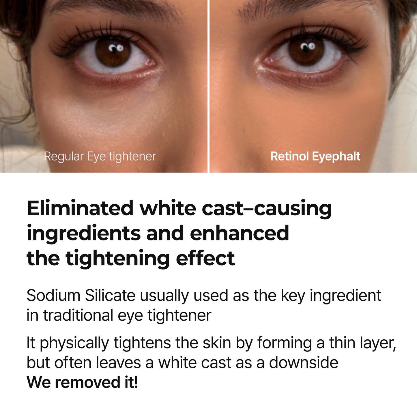 [Dzień i noc] Eyephalt Eyebag Lifting Line