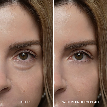[Dzień i noc] Eyephalt Eyebag Lifting Line