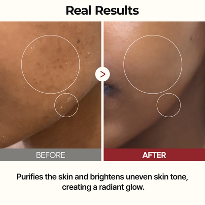 Tonik z ryżu Peel Shot Glow