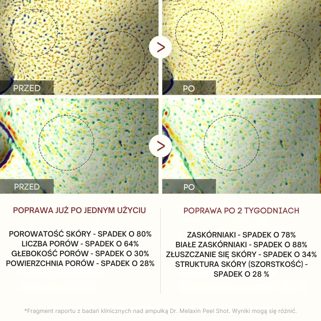 Dr.Melaxin - Peel Shot Ryżowy Peeling