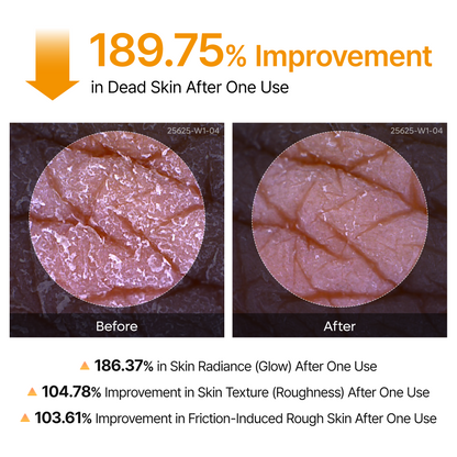 Spray do pielęgnacji keratynowej Peel Shot Kojic Acid Turmeric