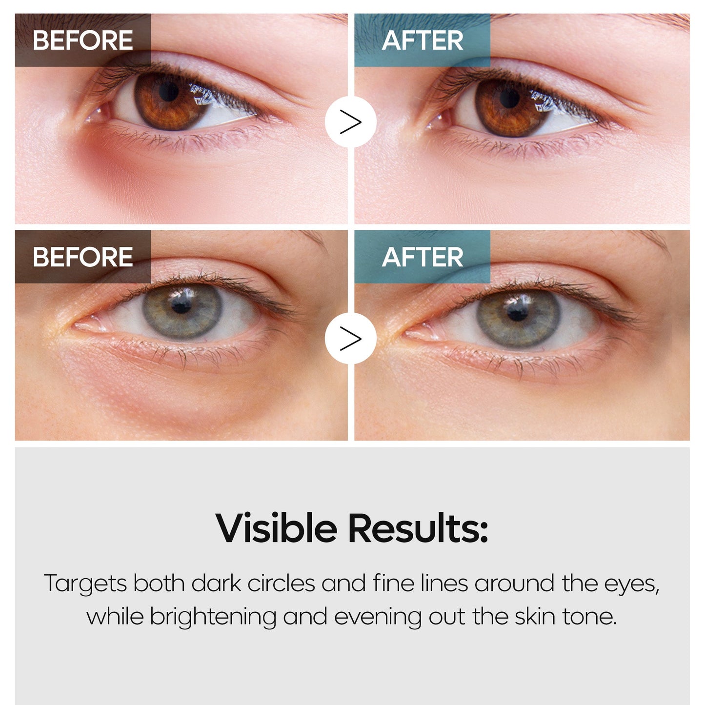 Krem pod oczy TX Retinalsome 40g